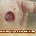 Điều trị ké Gà Đá: Dấu hiệu và cách nhận biết từ Ga6789